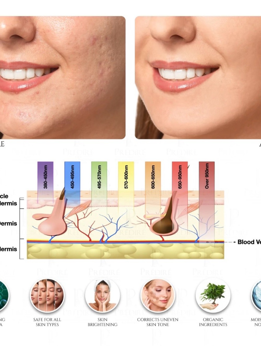 8 Element Multi-Purpose Skincare Mask | Non-Surgical Solution LED Treatment NIB! - Picture 6 of 10
